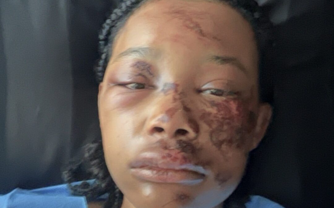 ‘Beyond grateful to be alive’: Victims of alleged racist attack in Spotsylvania speak out