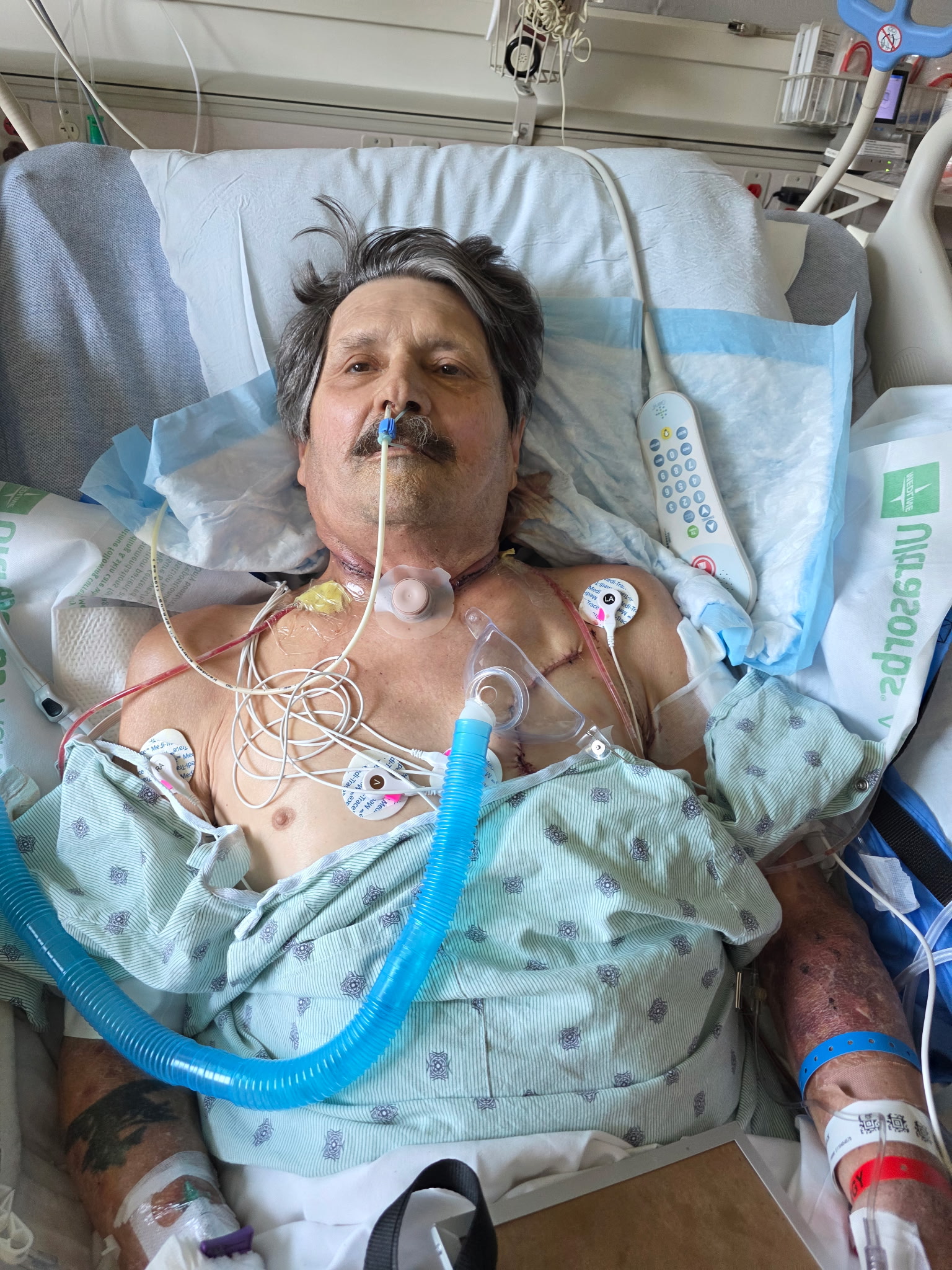 Rick Post Rick post-surgery May 26 | Fredericksburg Free Press